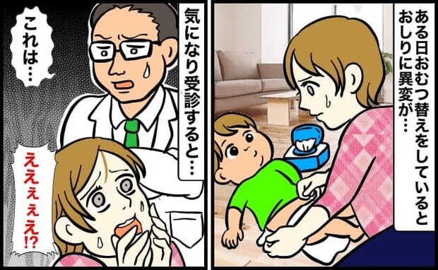 「おしりに小さな穴が…？」おむつ替え中、わが子の異変を発見！すぐに大学病院を紹介され…診断結果は