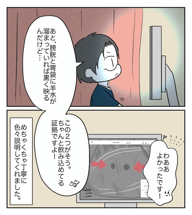 不妊治療で妊娠した私の妊娠記録／kiki