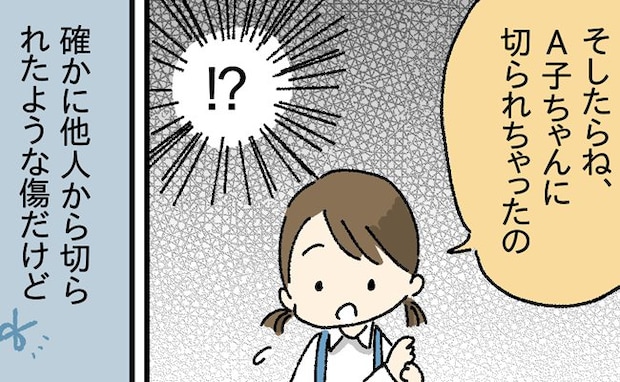 「切られちゃったの」指にケガをして帰ってきた娘→子ども同士で？刃物で？傷つけた？幼稚園で一体何が
