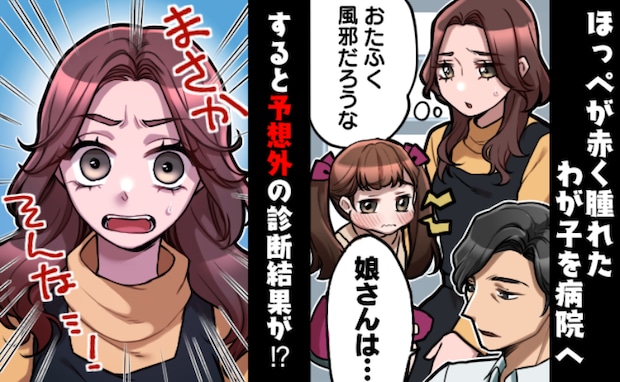 幼稚園でおたふく風邪が流行中、わが子の頬がパンパンに→「うちも？」医師が告げた診断結果…まさか！