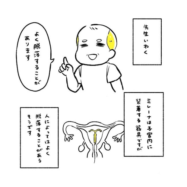 ミレーナ挿入レポ／ほけ
