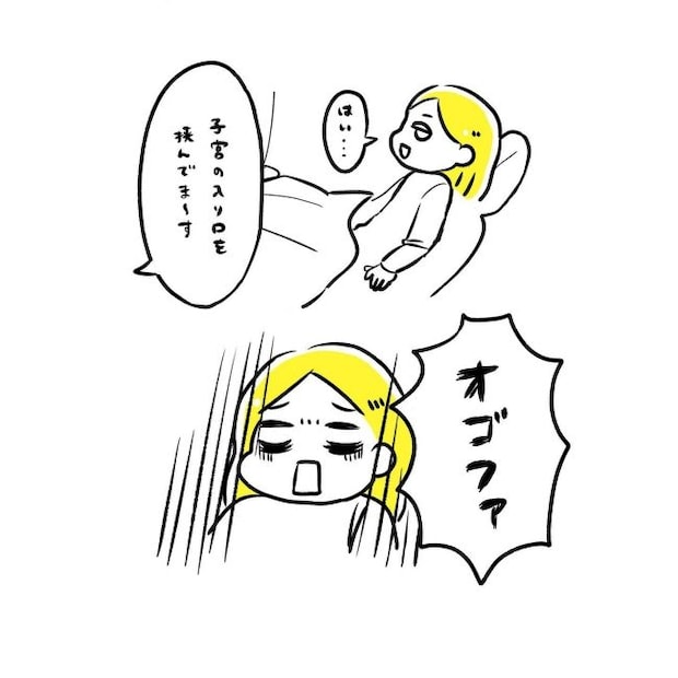 ミレーナ挿入レポ／ほけ