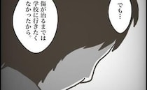 「傷が…」不登校だった生徒が学校へ。友だちに理由を尋ねられた少年の答えに違和感＜小学生トラブル＞