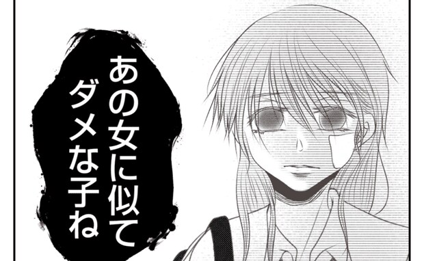 家族に疎まれるあざだらけの少女「あの女に似てダメね」絶望的な現実…唯一の救いは？＜義姉トラブル＞