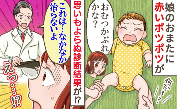 娘の下半身に赤いポツポツ…医師「治すのに1カ月はかかると思って」えっ？おむつかぶれじゃないの！？