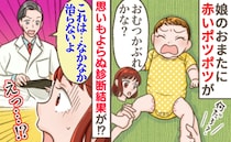 娘の下半身に赤いポツポツ…医師「治すのに1カ月はかかると思って」えっ？おむつかぶれじゃないの！？