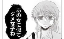 家族に疎まれるあざだらけの少女「あの女に似てダメね」絶望的な現実…唯一の救いは？＜義姉トラブル＞