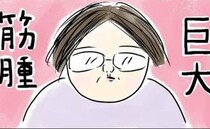 「できてしまいました」初めて婦人科へ行き見つかったもの＜巨大筋腫＞