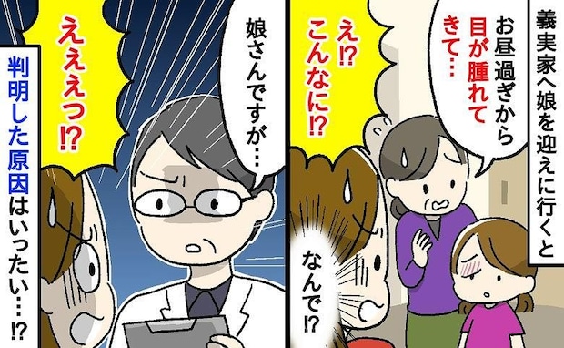 義実家に預けた娘の「目が半分しか開かない」…母は顔面蒼白！病院で検査の結果、医師に告げられたのは