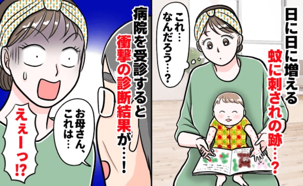 息子の虫刺されが日に日に増えていく「なんで?対策してるのに…」念のため病院へ行くと、驚きの診断が