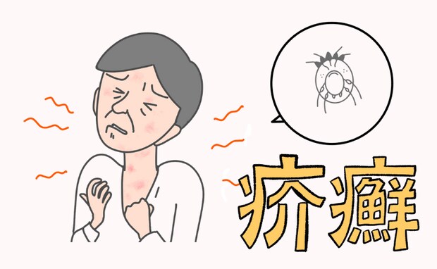 介護現場を混乱に招く!?中高年世代が注意したい皮膚感染症「疥癬」のリスク【医師解説】