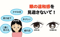 目がかすむのは「老化」だけじゃない！年齢に関係なく発症する「白内障」のサインと予防法【医師解説】