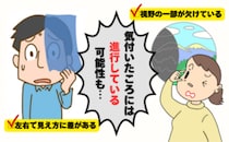 日本の失明原因「第1位」見え方の「欠け」は疲れ目じゃない！？緑内障のサインと予防法【医師解説】