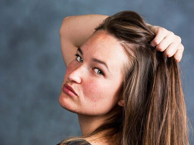 残暑の頭皮トラブル、べたつきも乾燥もすっきりさよなら！ケア法3選