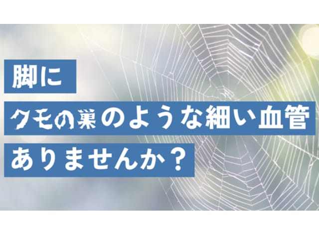 「脚に“クモの巣のような細い血管”…？」 実は治せる！冬が治療のベストタイミングの理由