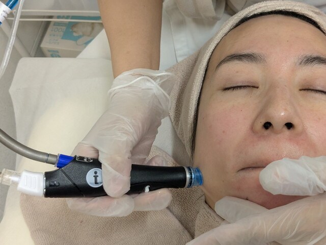 ハイドラフェイシャル