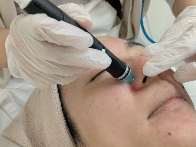 【東京・渋谷】汚れゴッソリ！痛くないのにここまで？ハイドラフェイシャルを体験！｜美容皮膚科『リゼクリニック』