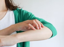 夏の赤みブツブツ、もう悩まない！汗による接触皮膚炎を知って夏肌を守ろう