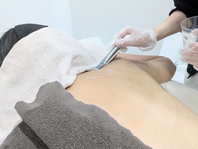 専用機器でプラピールの施術を行っている様子