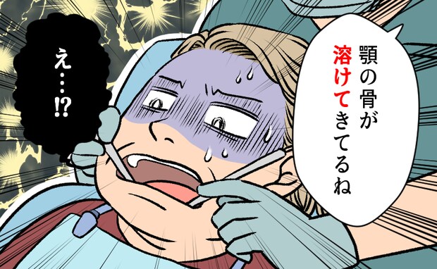 「まさかの顎骨壊死…」更年期を甘く見ていた私が直面した、歯の違和感の正体【体験談】