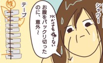 「意外と早くくっつくのね」手術後4日目にはシャワーを浴びても痛みなし＜子宮筋腫で手術に！？＞