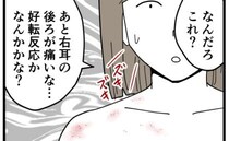 「なんだろこれ？」痛みが悪化。さらに右肩あたりに赤い発疹が現れて＜帯状疱疹＞