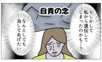 「治してあげたい」娘のまぶたの白斑。母が直面した予想外の展開とは＜娘の尋常性白斑＞
