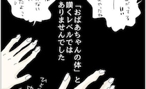 「おばあちゃんの体」と嘆くレベルじゃない！？小指が変形したアラフォー同士で共感