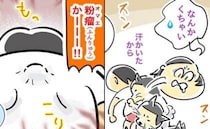 「背中が臭い！」夫の疲労チェックで気付いた異臭！気になるにおいの正体は＜粉瘤クサ男＞