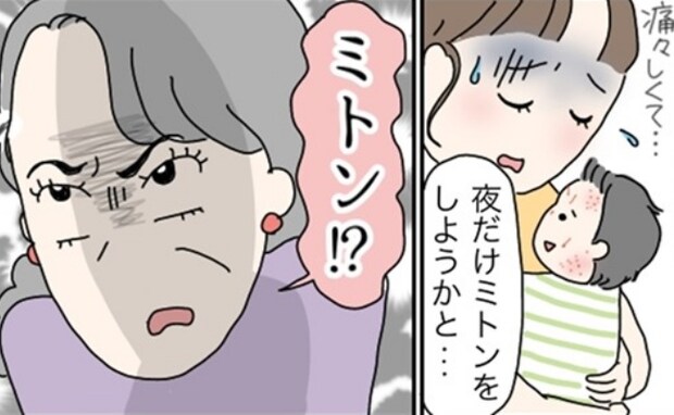息子の顔が血だらけに…「ひっかき防止の手袋を使いたくて」と義母に話したら猛反対!理由を聞いて呆然