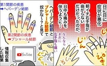「手の痛みが悪化」関節リウマチは陰性。痛みの原因は一体…悩んだ結果＜手指のこわばり＞