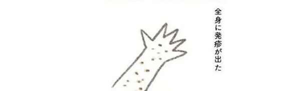 夫を亡くしたストレスから? 全身に原因不明の発疹が/旦那が突然死にました。