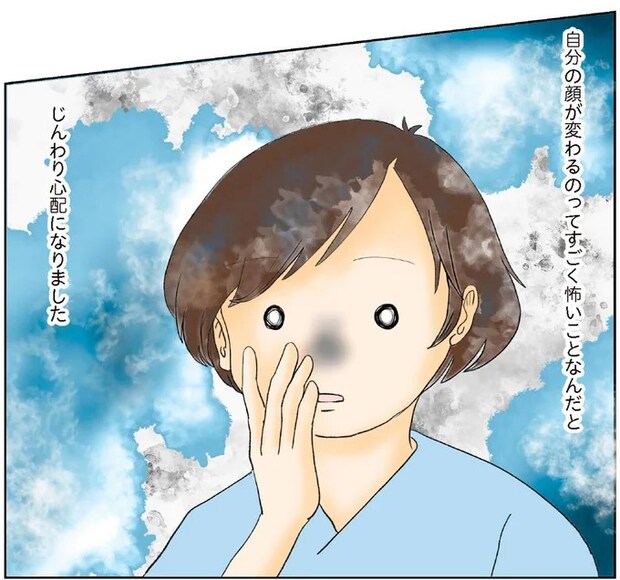 麻酔が切れて眠れない！ ガン手術後に襲ってきた腹立たしいほどの激痛で「過酷な夜」に／続 鼻腔ガンになった話
