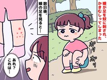＜秋なのに、蚊！？＞公園で、幼い娘が蚊に刺されてしまった。翌朝 → 病院で『まさかの診断』が！