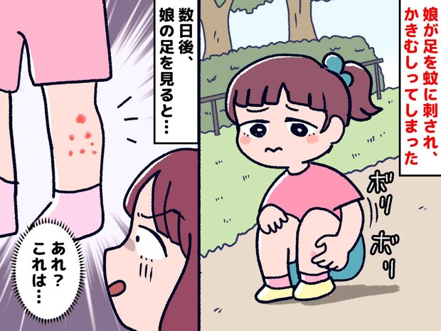 <秋なのに、蚊!?>公園で、幼い娘が蚊に刺されてしまった。翌朝 → 病院で『まさかの診断』が!