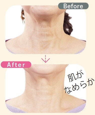 大山志津子（おおやま・しずこ）さん（当時63歳）