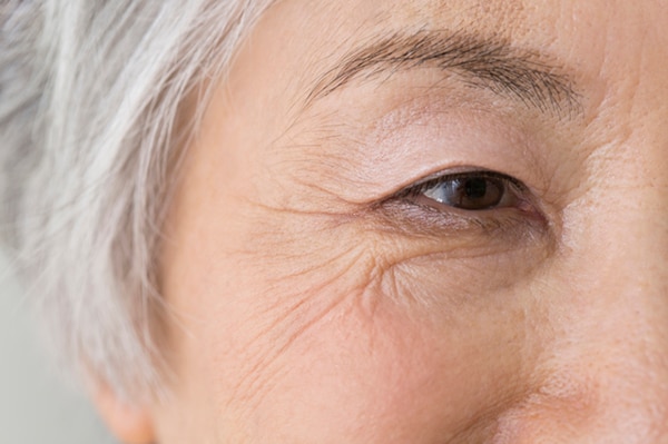 まぶたのたるみは心身の不調の原因にもなる