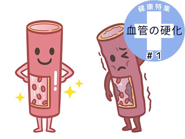 放っておくと怖い…血管の詰まりを予防する7つの習慣【医師監修】