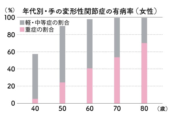 50代の約5人に1人が手指の疾患を抱えています