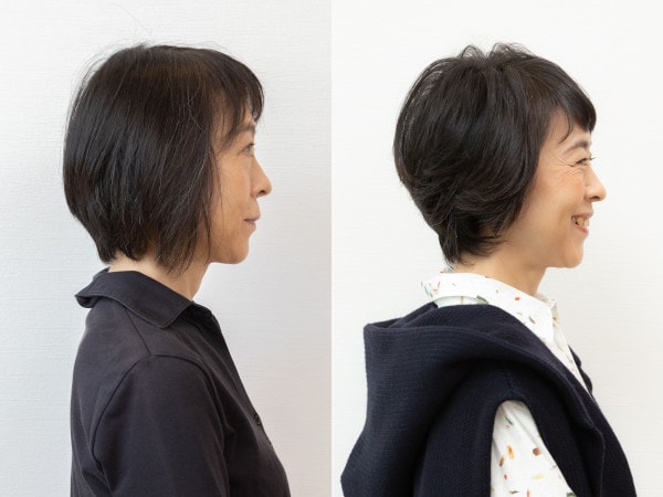 【サイド】Before：顔まわりの髪で暗い印象→After：前上がりにカットして明るい印象に