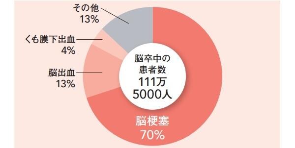 突然発症し、寝たきりの原因にもなる脳卒中。その7割が脳梗塞です