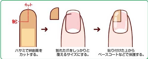 【割れ爪】割れたときの応急処置。絆創膏でできる簡単ケア