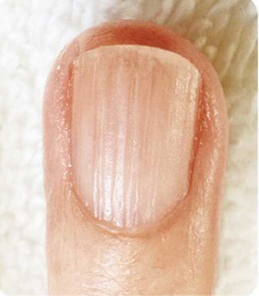 【縦筋】老化だけじゃない!? 原因&ケア方法