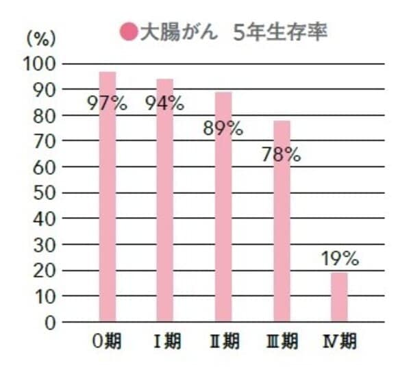 大腸がん　胃がん　検査