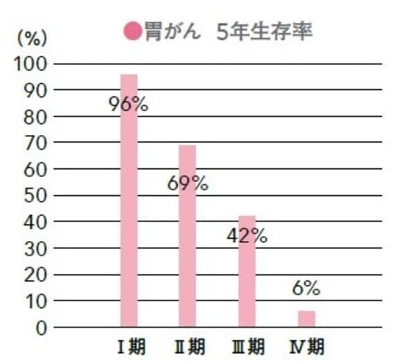 大腸がん　胃がん　検査