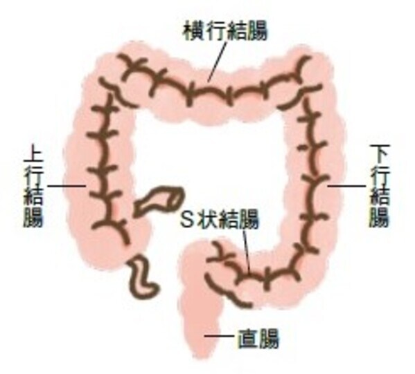 大腸がん　胃がん　検査