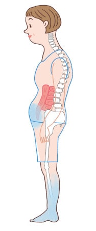 偏った姿勢による体のゆがみが原因の一つ