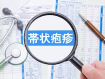 【帯状疱疹】50代以降の女性は「危険度チェック」で確認！予防のためには何をする？