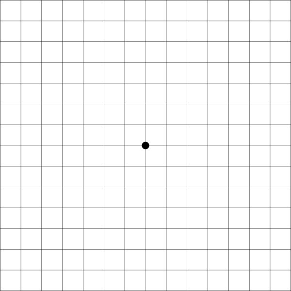 アムスラーチャート