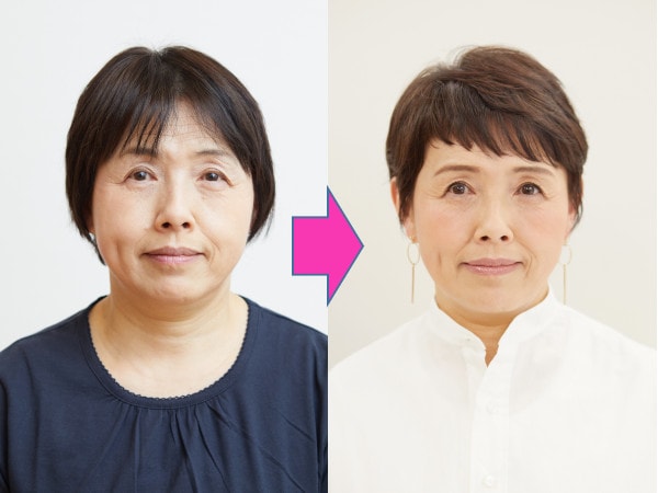 イメチェンビフォーアフター（フロント）：佐々木恵子さん（61歳）